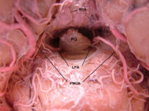 the-pineal-gland-PG-shaped-like-a-pinecone-pin-cone-in-posterior-view